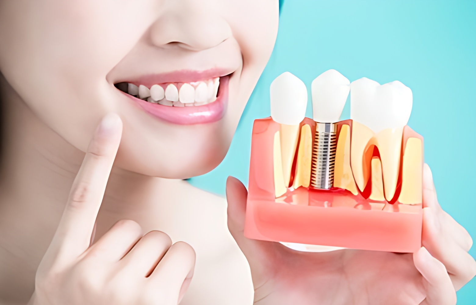 benefits-dental-implant-istanbul-turkey