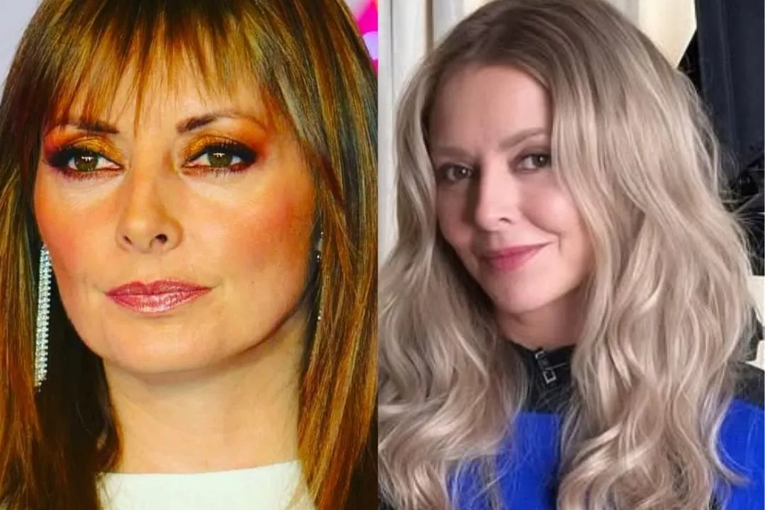 carol-vorderman-facelift