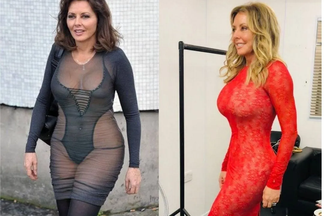 carol-vorderman-tummy-tuck