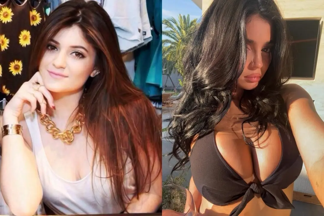 kylie-jenner-breast-augmentation-before-and-after-