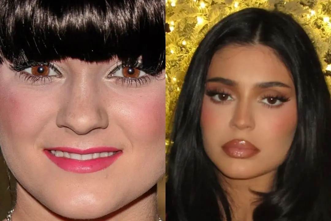 kylie-jenner-nose-aesthetics-before-and-after