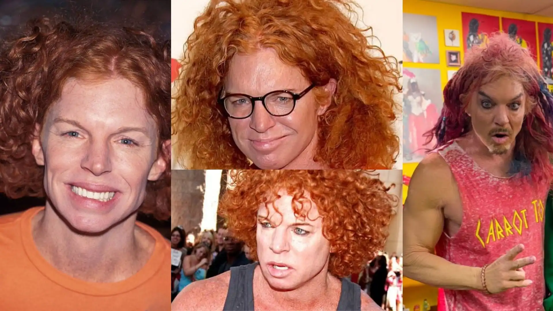 Carrot Top Plastic Surgery Before and After