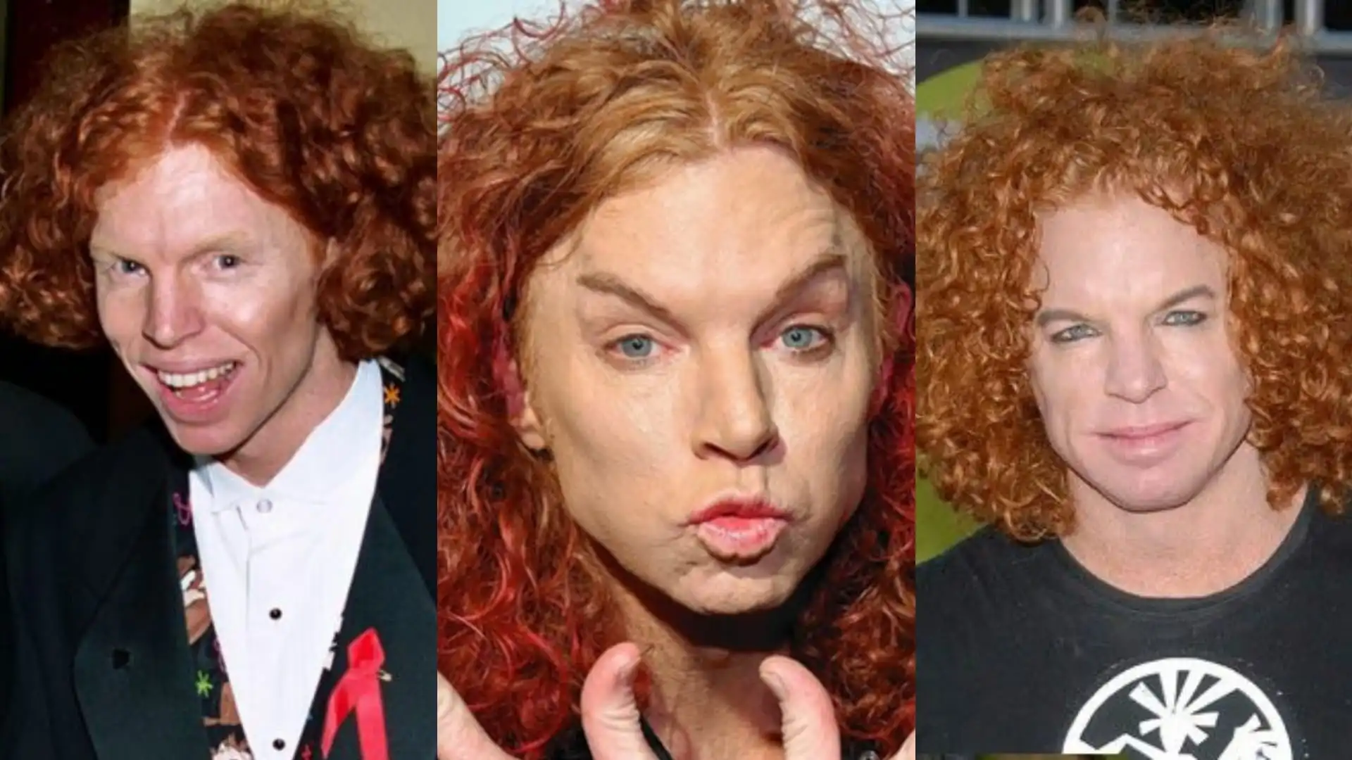 Carrot Top Plastic Surgery Before and After