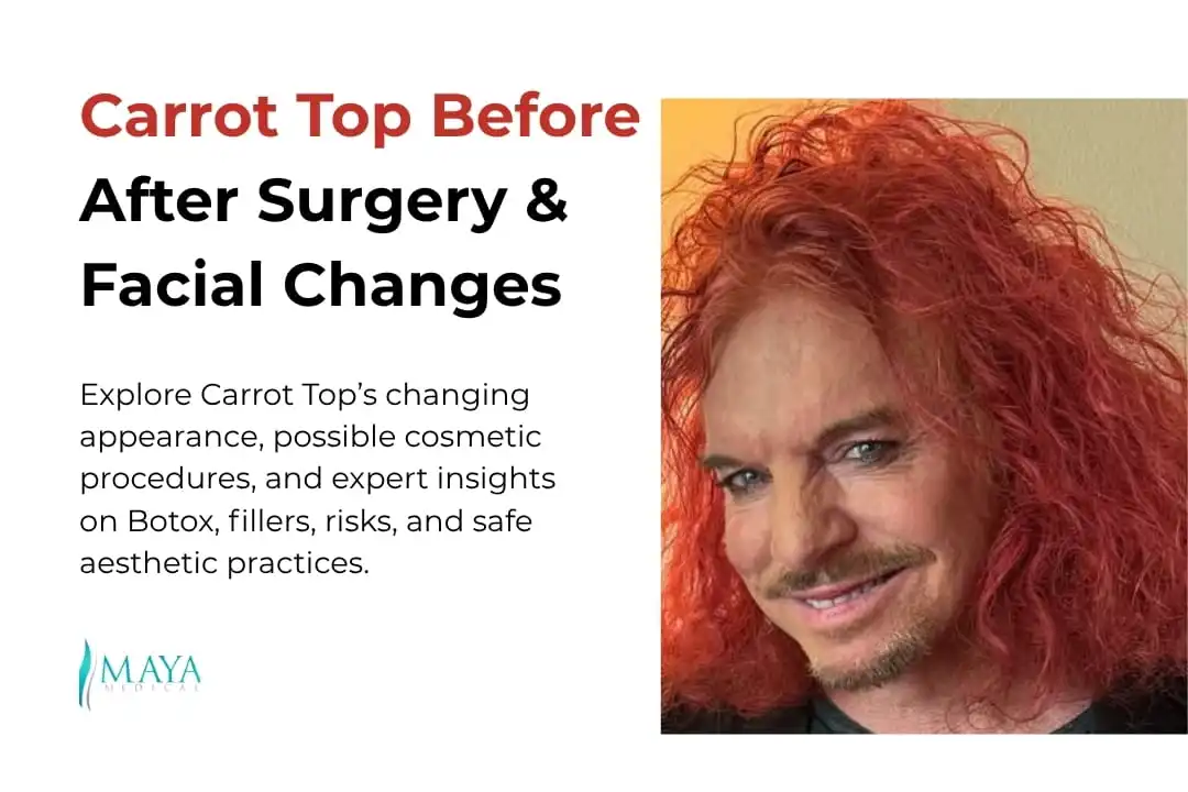 Carrot Top Plastic Surgery Before and After